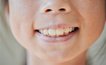 「ろうそくが吹き消せないのは歯のせい？」虫歯がなくても要注意！いま子どもの口に起きている「深刻な問題」